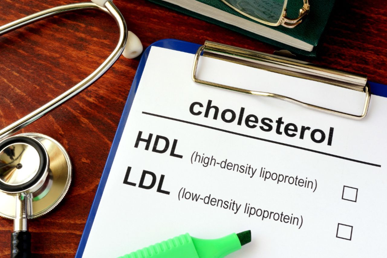 Co to jest cholesterol HDL? Dobry cholesterol, jakiego potrzebujemy