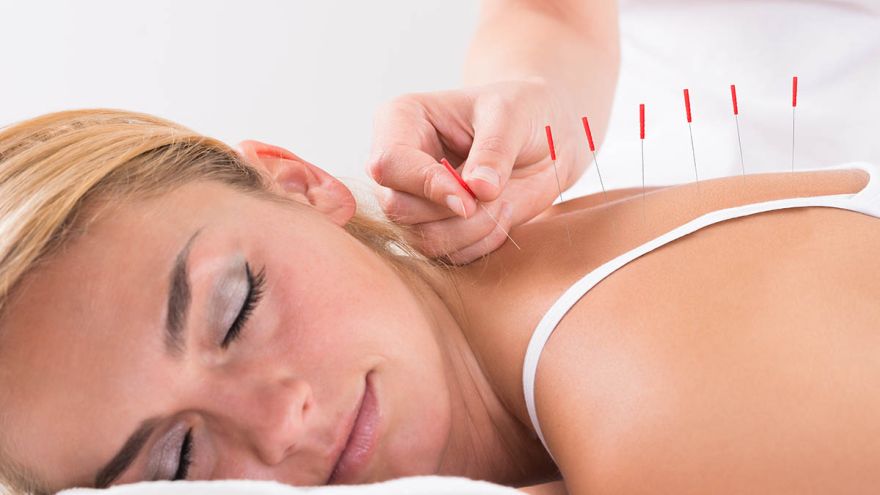Akupunktura Akupunktura zwalcza przewlekły stres