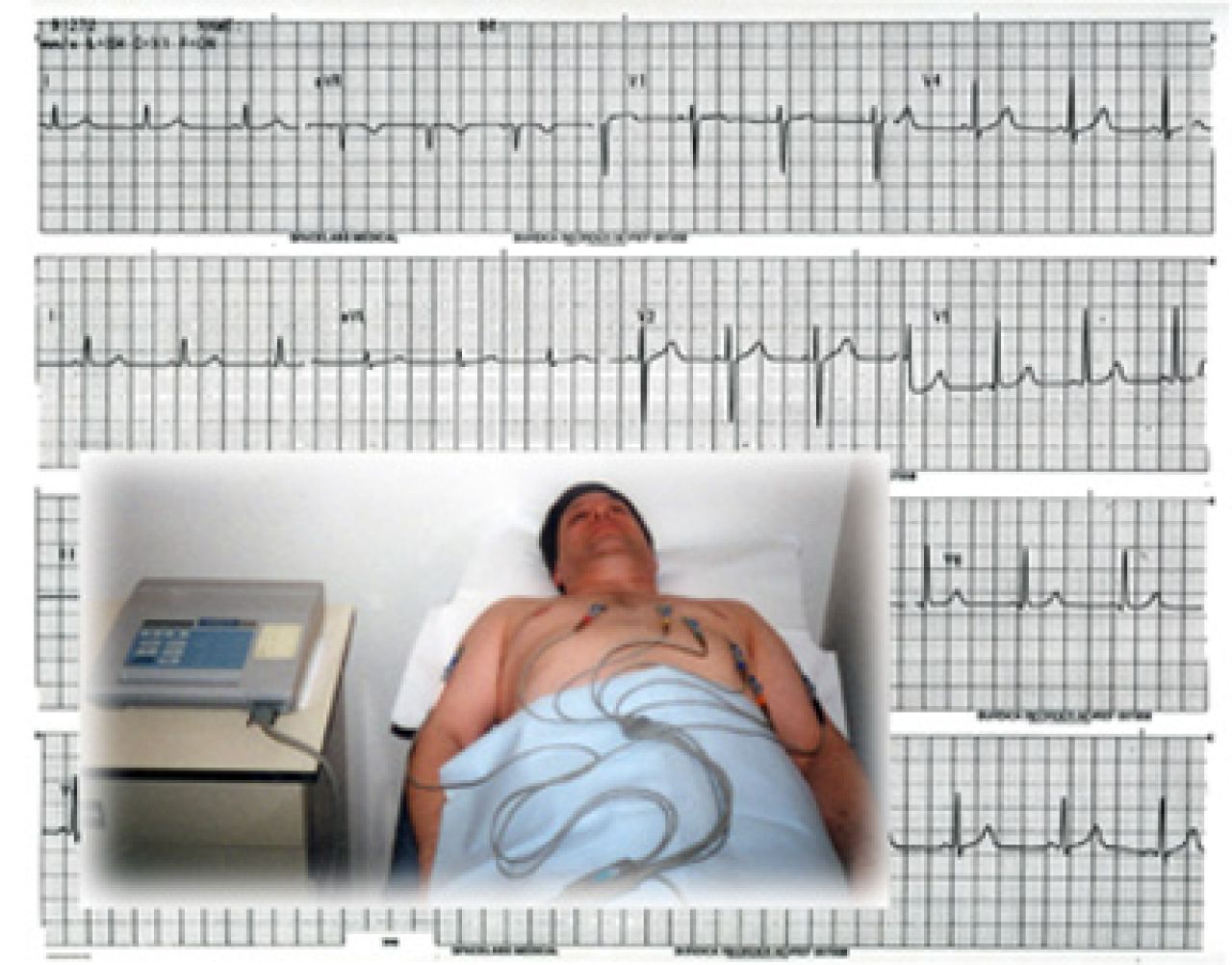 Badanie EKG