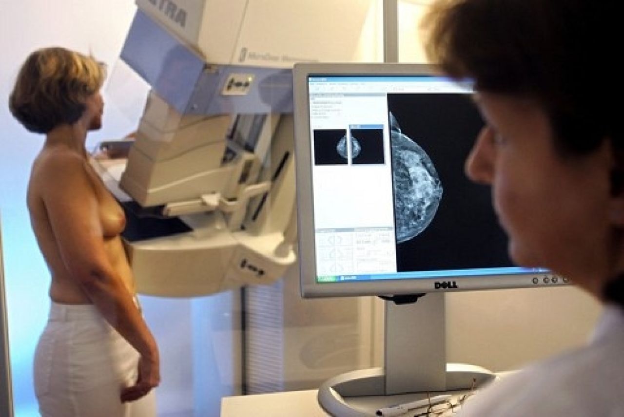 Mammografia ratuje życie!