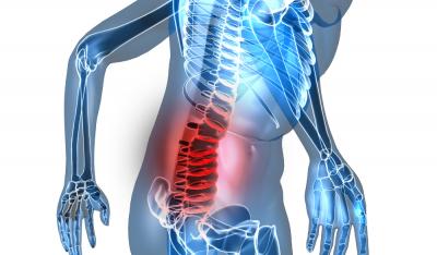 Ćwiczenia zmniejszające ból kręgosłupa