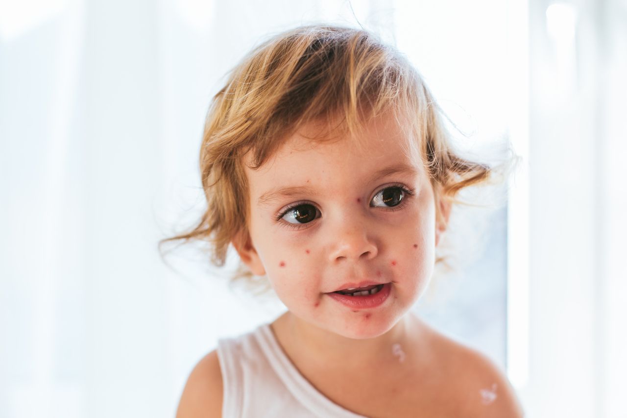 Choroby zakaźne wieku dziecięcego – czy warto szczepić na nie dzieci?