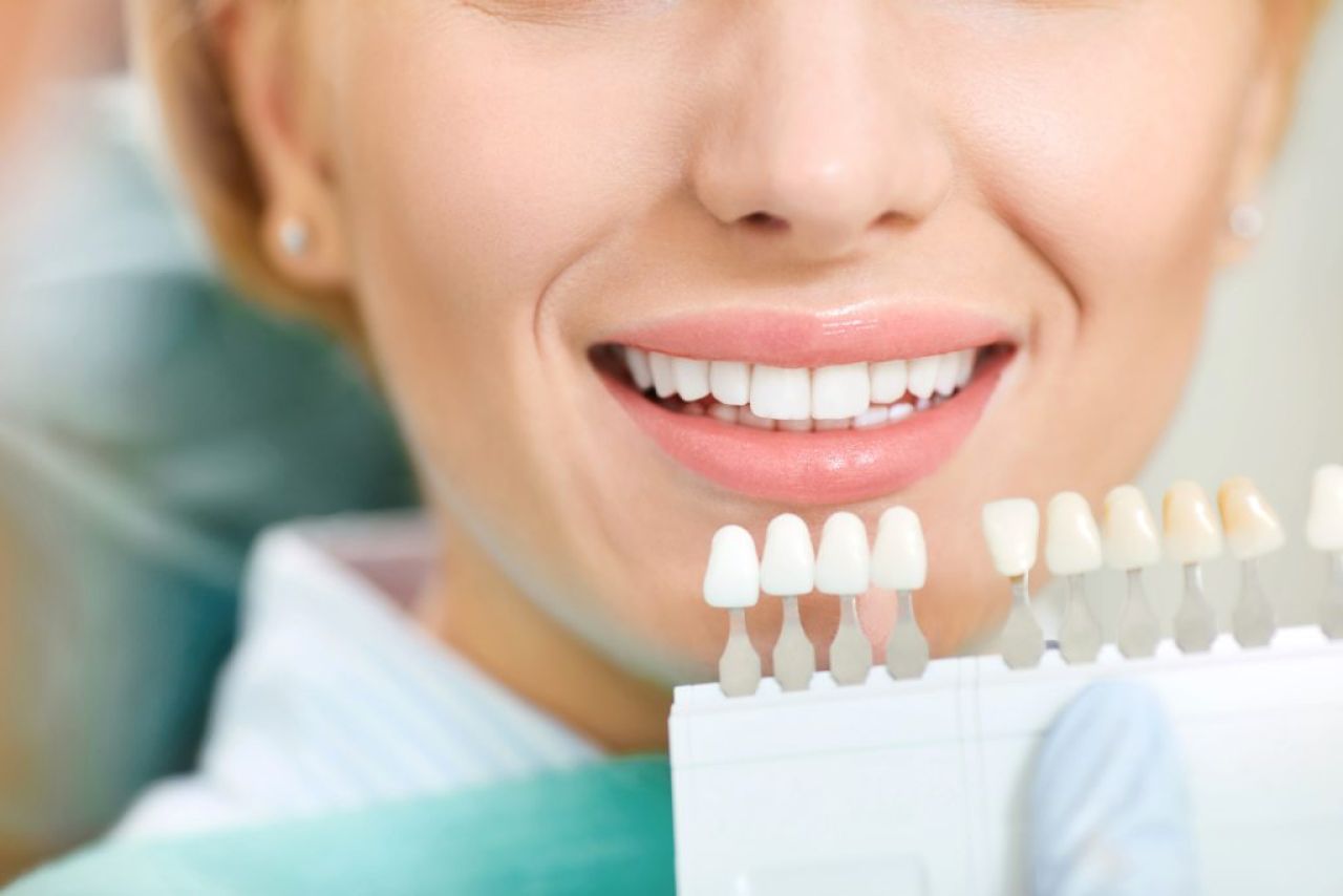 5 mało znanych przyczyn przebarwień zębów i jak je usunąć