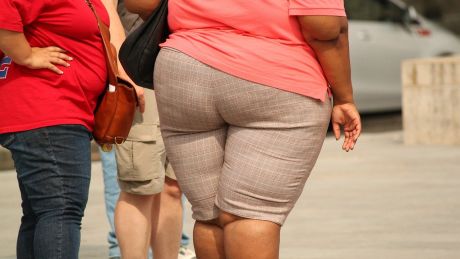 Czy otyłość to faktycznie choroba? 5 pytań, które burzą stereotypowe myślenie o otyłości